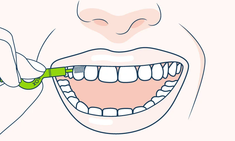 cepillado-de-dientes-en-espacios-interdentales-curaprox