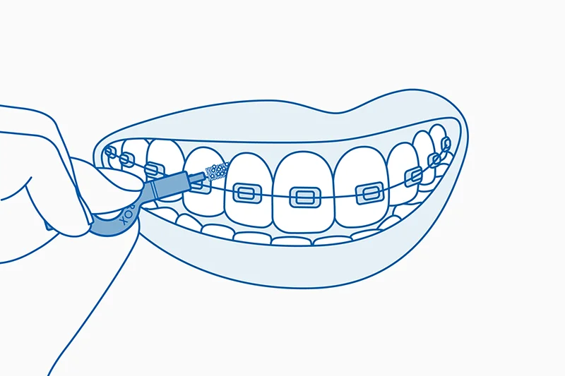 limpieza-con-interdentales-curaprox