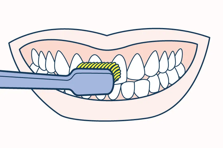 limpiza-dental-con-cepillo-de-dientes-suave