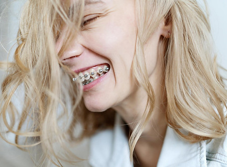 mujer-joven-con-brackets