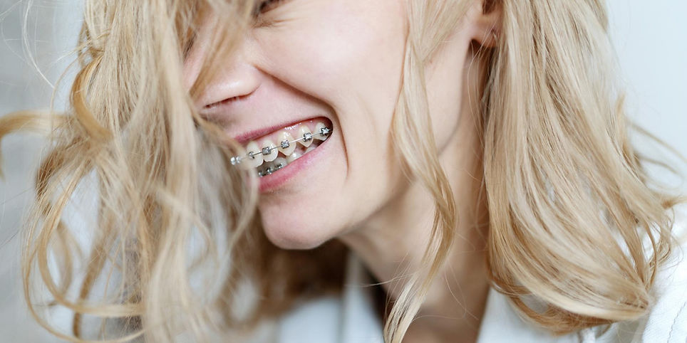 mujer-sonriendo-con-brackets